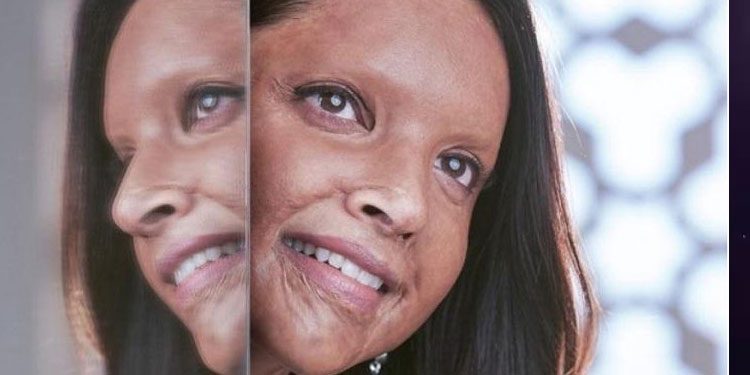 Bombay High Court Clears Release of ‘Chhapaak’